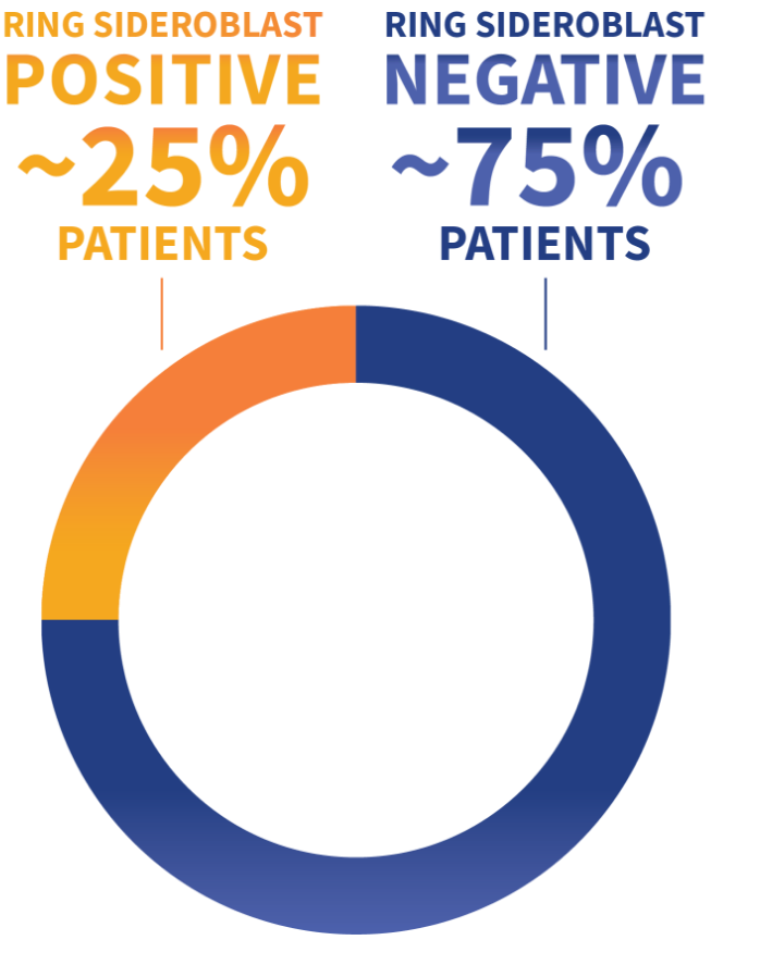 Pie chart graphic showing 75% ring sideroblast negative and 25% ring sideroblast positive.