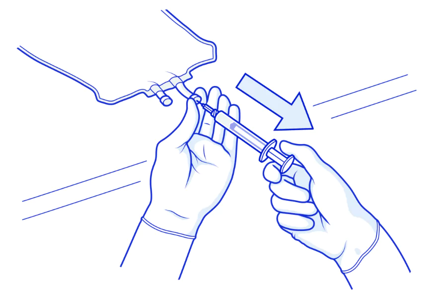 Step 2 illustration with a syringe going into an IV bag with an arrow facing away.