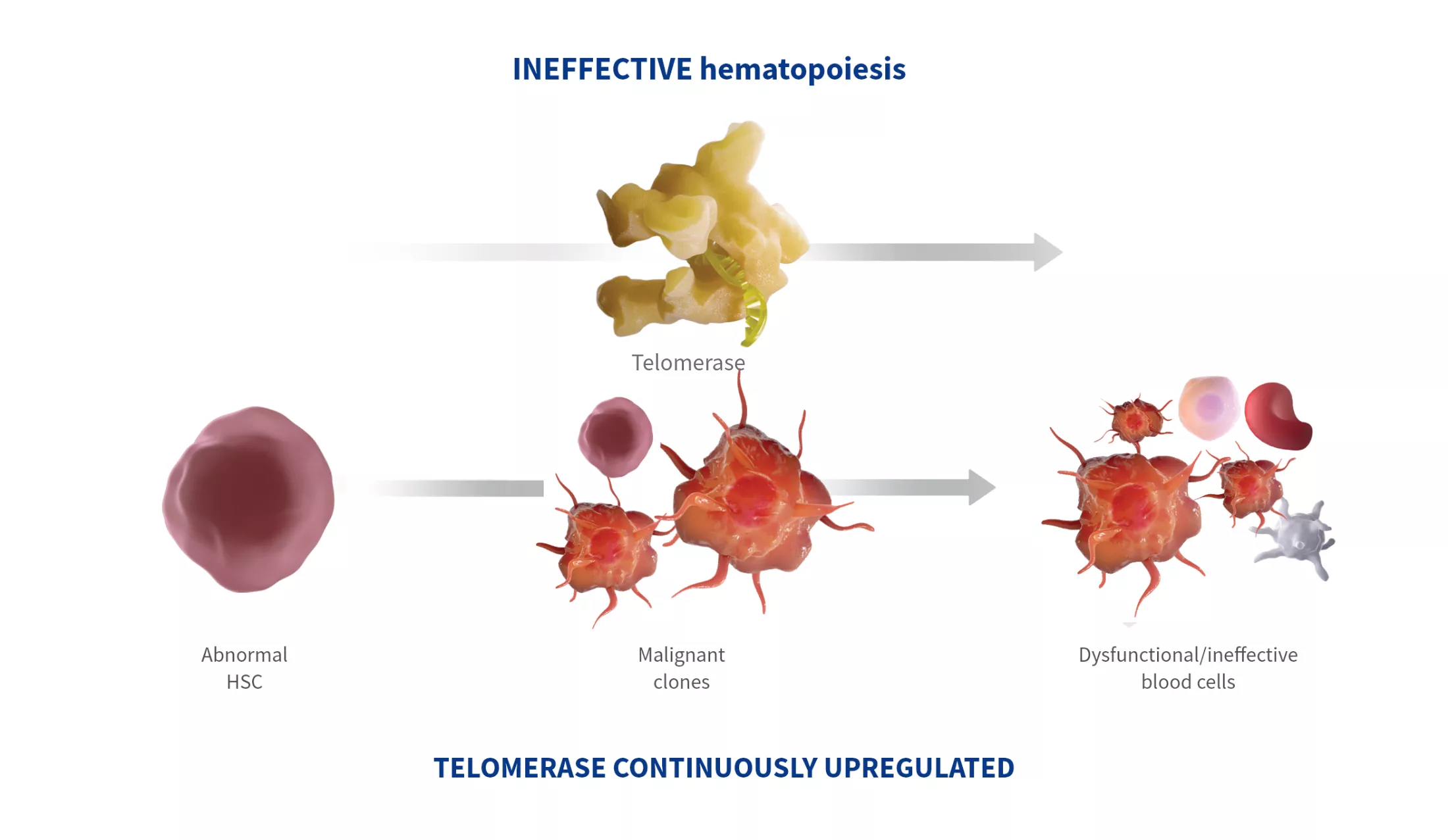 Graphic of a diagram showing maglinant stem cells developing into dysfunctional blood cells due to telomerase overexpression.